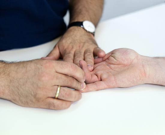 Foto von einer klinischen Untersuchung einer Hand im Handzentrum Köln. Leistungen des Handzentrum Köln